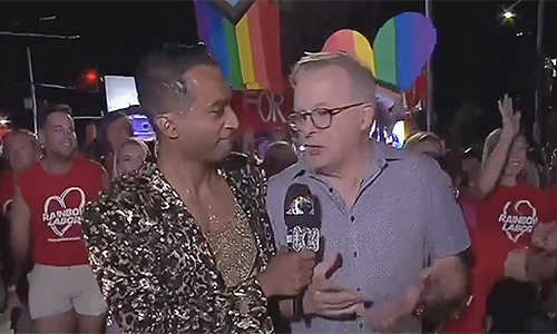 The disaster of sequinned, brain-infected men