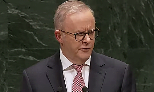 Albo admits nobody likes him